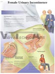 Female Urinary Incontinence - Anatomical Chart